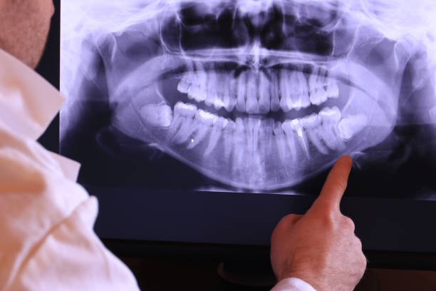 Best Emergency Dental Surgery in Bismarck, MO